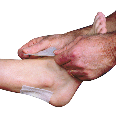 Mueller Fersen-und Schnürpolster Anwendung Mueller Fersen- und Schnürpolster Anwendung am Sprunggelenk 080201
