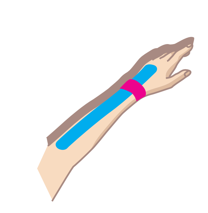 Nasara Kinesiologie Pain Pack HAndgelenk Beispiel
